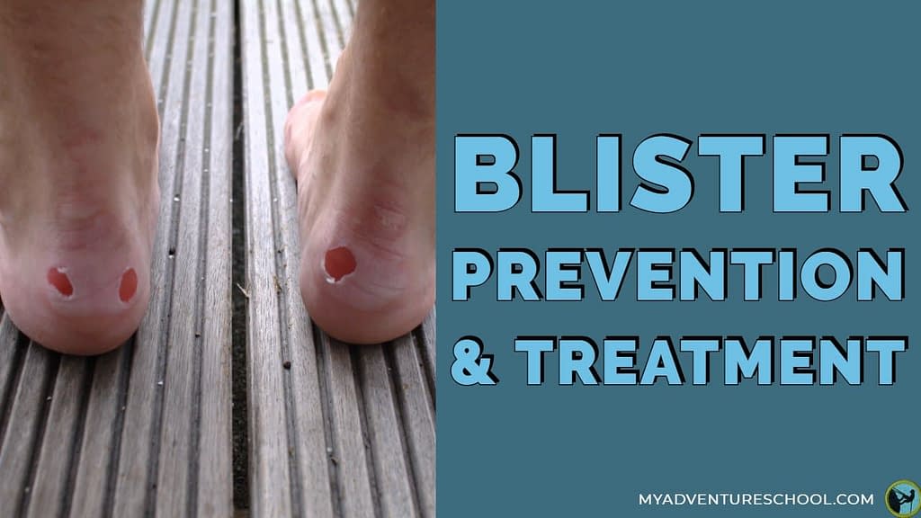 Blister prevention and treatment